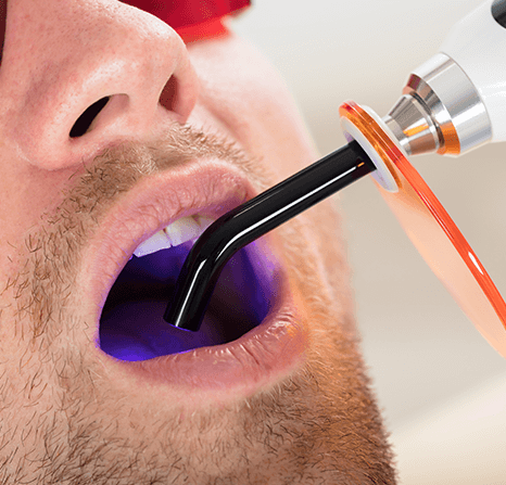 Dentist filing in patient's cavities.